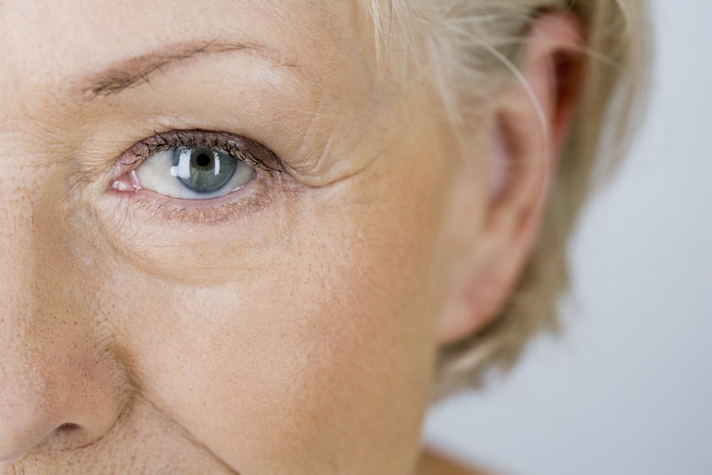 Close-up of a woman's eye area, showing fine lines