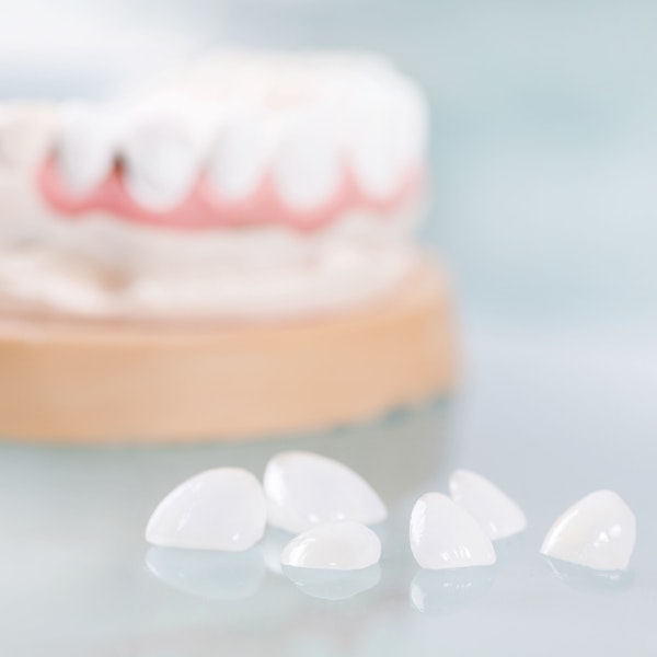 e.max® veneers